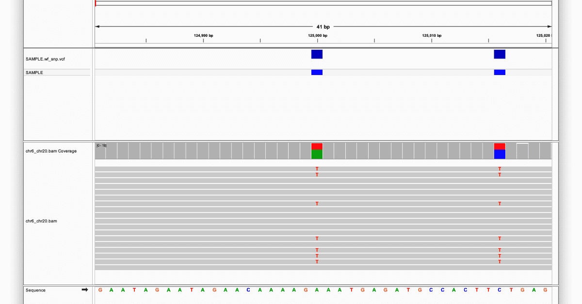 IGV coverage and alignment view showing two heterozygous SNVs with a VCF track above