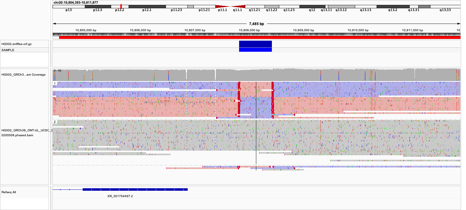 IGV view of HG002 ultra-long nanopore reads at a chr20 locus: the top track linked and colored by read strand showing a block of reverse-strand reads flanked by forward-strand reads, and a second, unstyled grey track below it