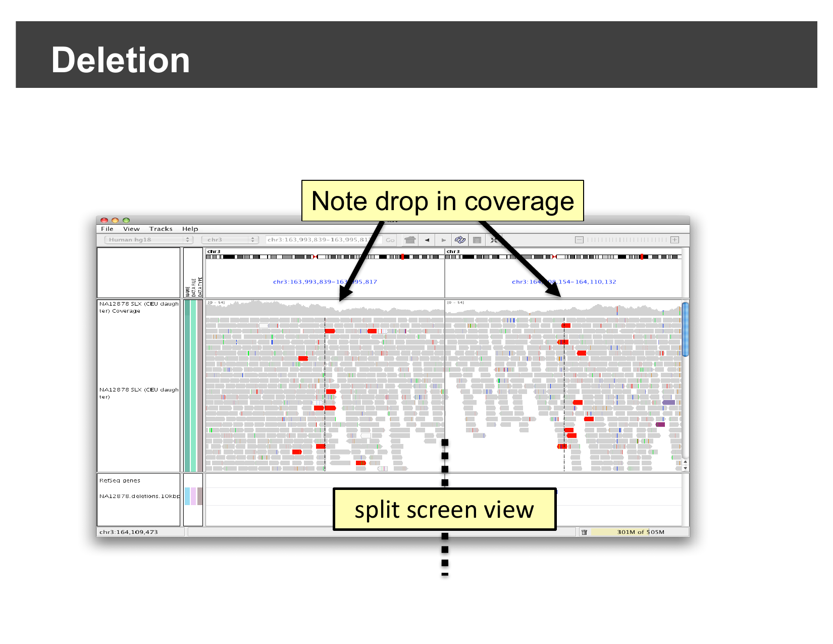 IGV split-screen view showing red discordant pairs and a coverage drop at a deletion breakpoint
