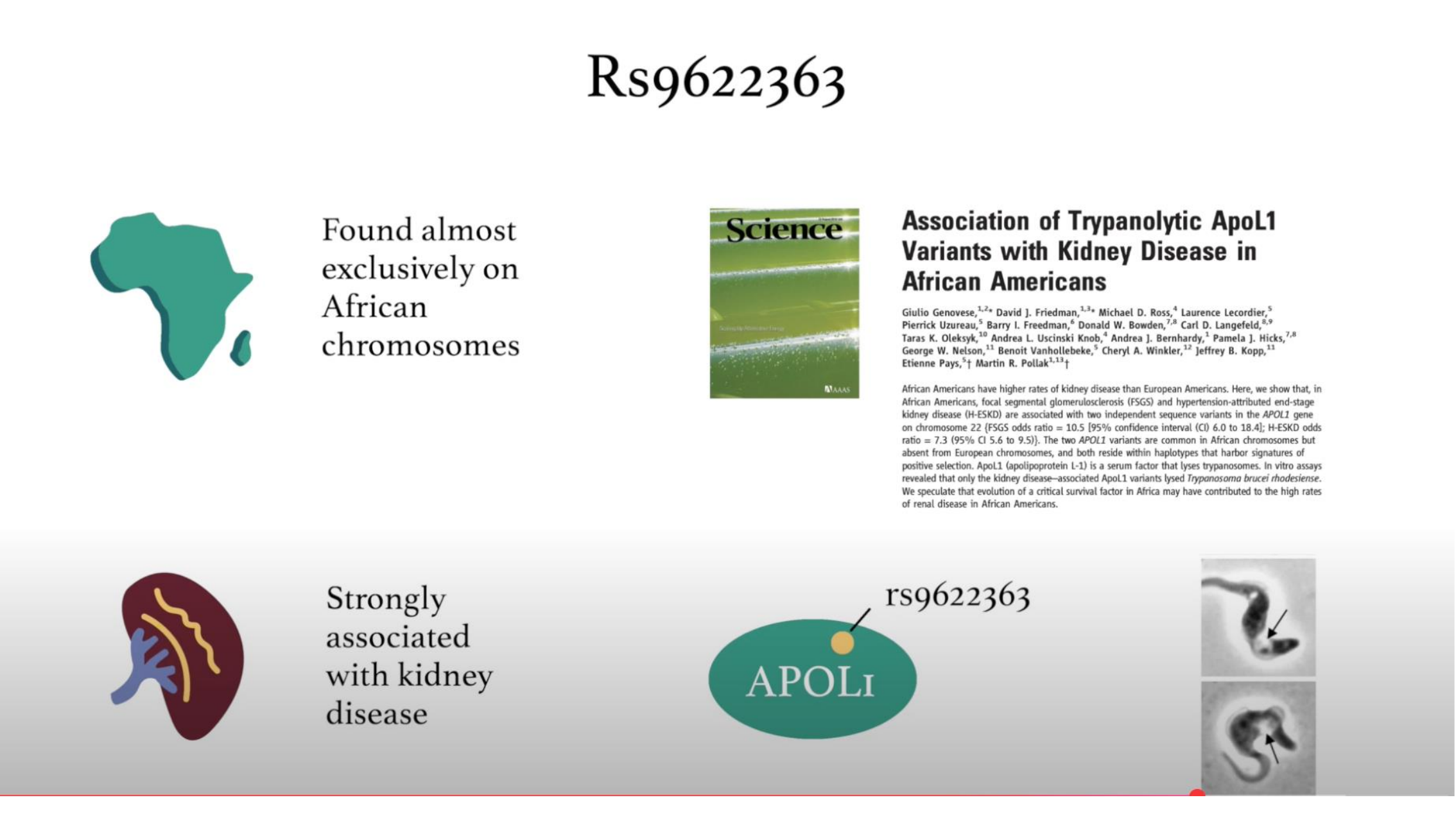 APOL1 background slide: African-specific variant associated with kidney disease and trypanolytic activity